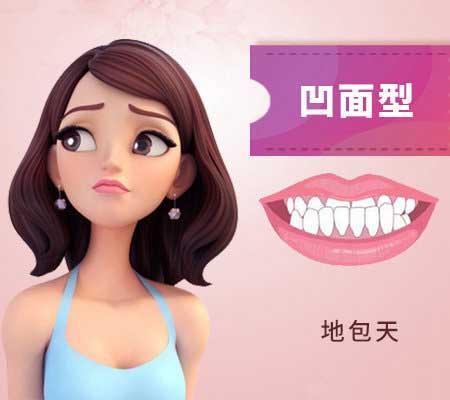 什么是地包天？地包天長(zhǎng)什么樣子？地包天牙齒圖片