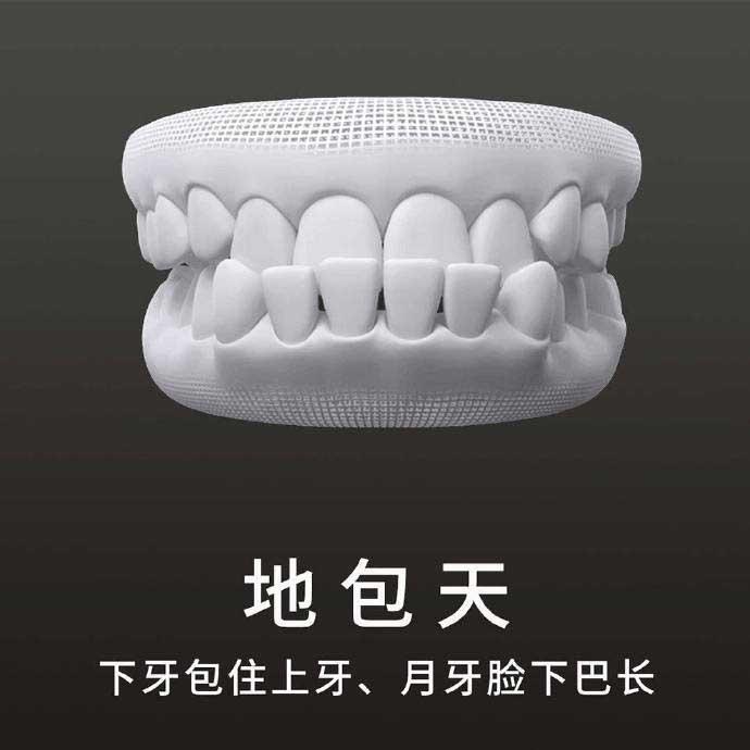 什么是地包天？地包天長(zhǎng)什么樣子？地包天牙齒圖片